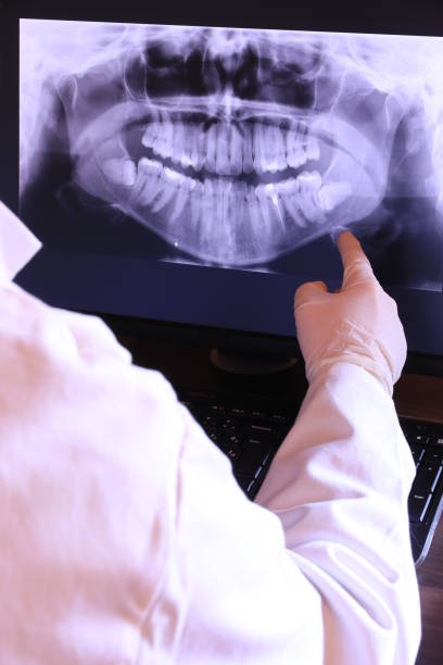 Best Emergency Treatment for Dental Infections or Abscesses in Lanster, CA