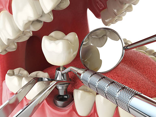 Fast & Reliable Emergency Dental Services in CA